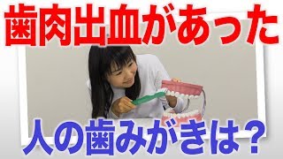 歯肉から出血があった人の歯みがき法