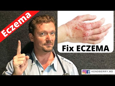 , title : 'Is this Causing Your ECZEMA? (Easy Way to Tell) 2022