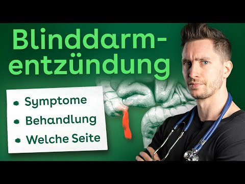Blinddarmentzündung: Welche Seite, Ursachen, Symptome, Diagnostik & Behandlung