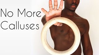 How to Avoid and Prevent Calluses | Calisthenics