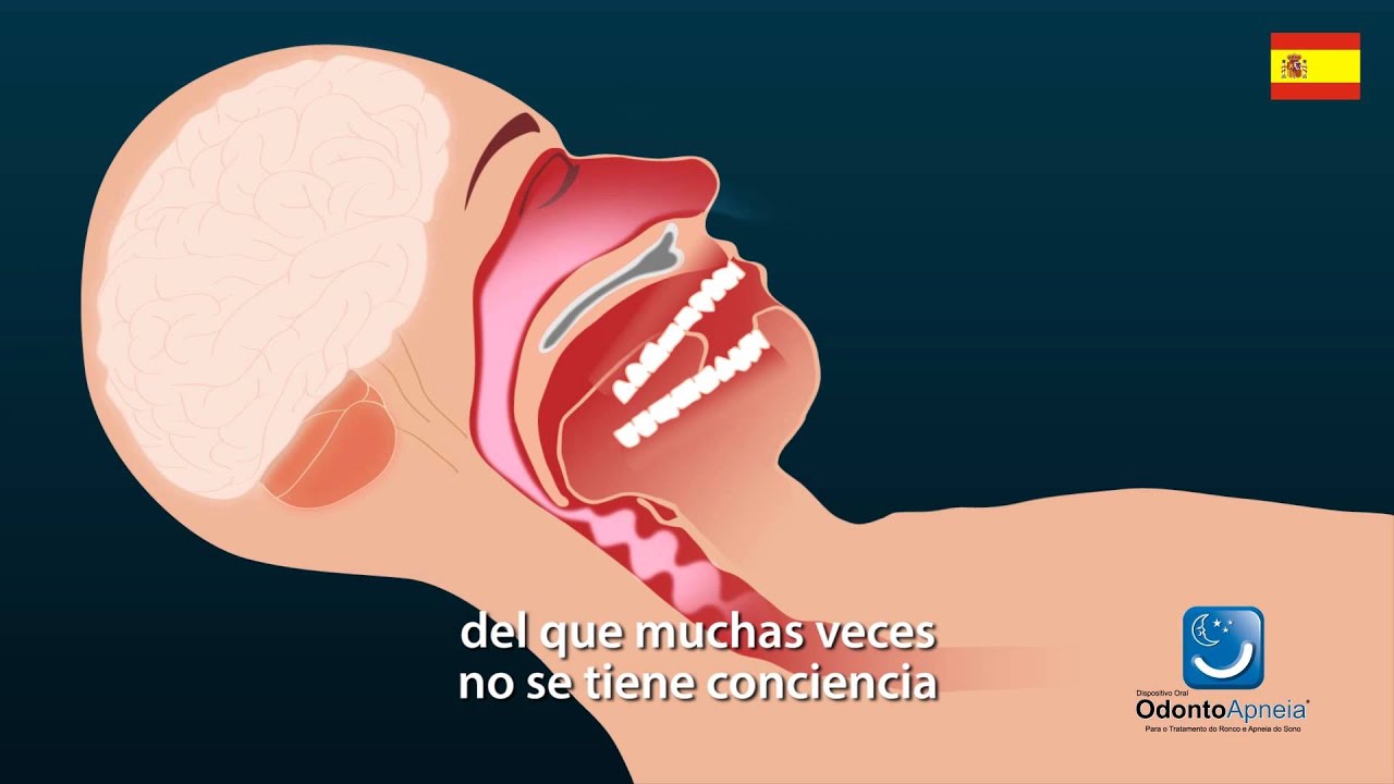 Angel Romo Saucedo-21