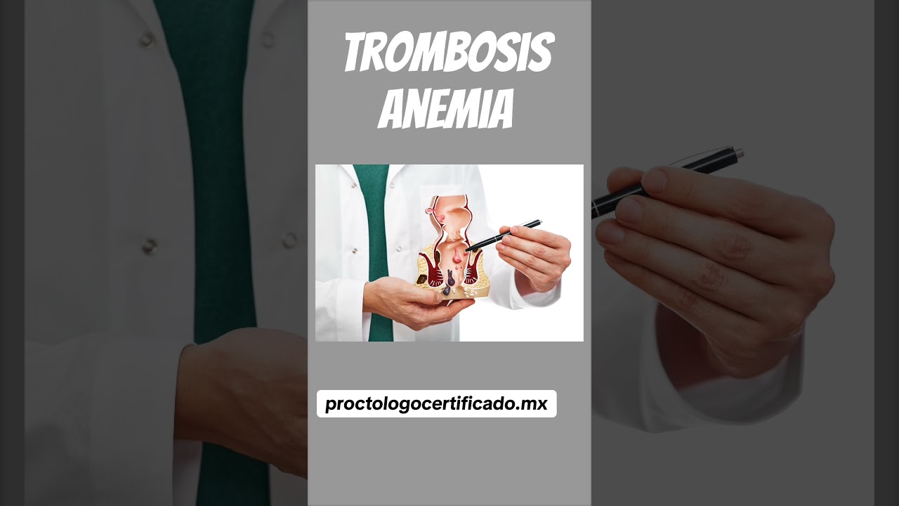 Adrián Martínez Herrera-21