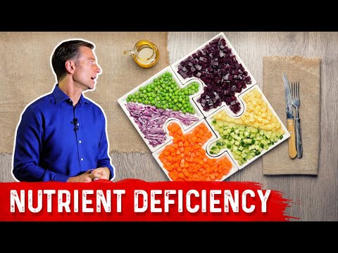 An APPLE a Day Will NOT Let Your Weight Go Away – Dr Berg