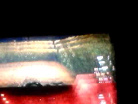 Pelataan Mixy Playerin kanssa black ops II Zombie Buried