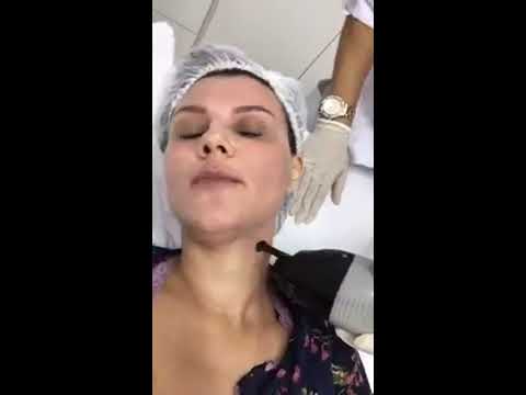 LIVE DRA DUAL DEEP CO2