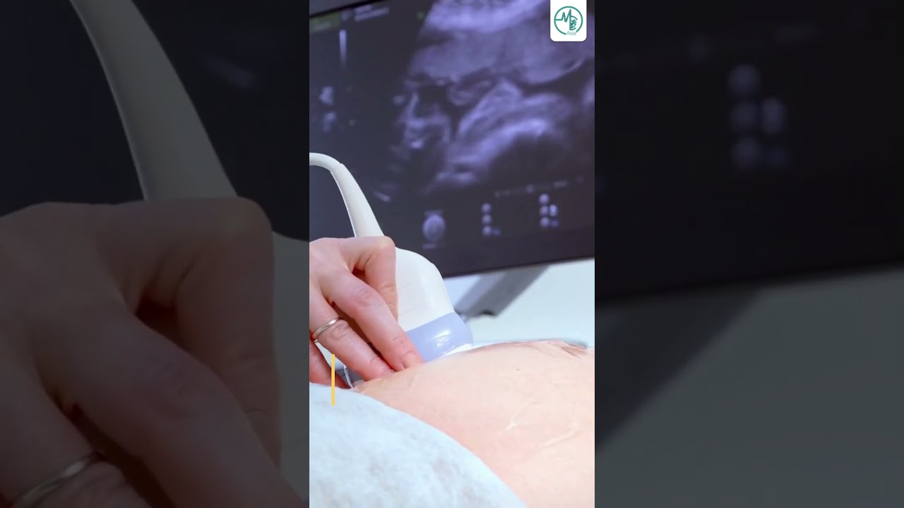 The Use of Ultrasound | #MCAshorts