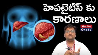 Hepatitis Management – Key Facts