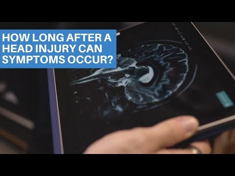 How Long After a Head Injury Can Symptoms Occur?