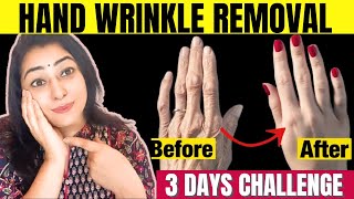 Remove Wrinkles from Hands | Make your Hands Look 10 Years Younger - Get Baby Soft Hands in 3 Days