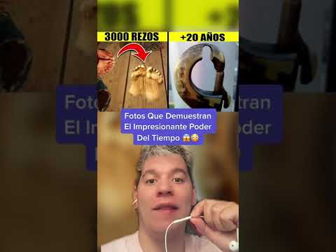 Fotos Que Demuestran El Impresionante Poder Del Tiempo 😱😳 #shorts #youtubeshorts #curiosidades