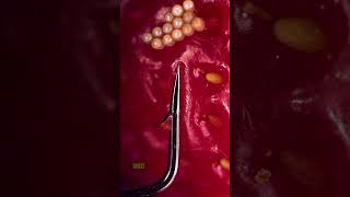 Download lagu Kail Pancing dan Stroberi | Suara orisinal yang dibuat oleh @OddioStudio Ikuti artis Foley ini! mp3