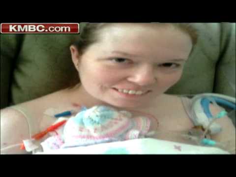 'Miracle' Premature Baby Overcomes Odds