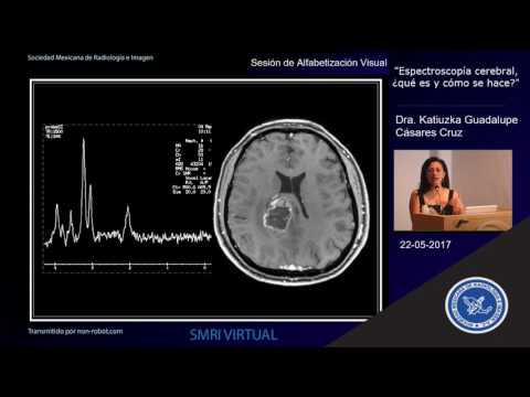 Espectroscopía cerebral, ¿qué es y como se hace?