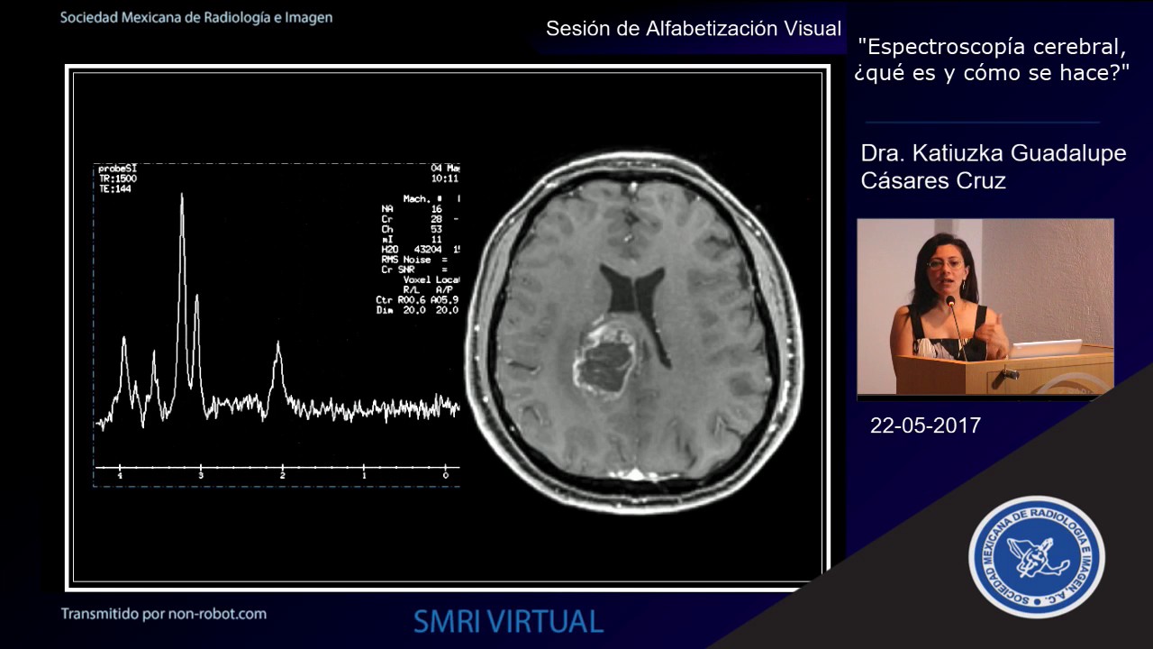 Espectroscopía cerebral, ¿qué es y como se hace