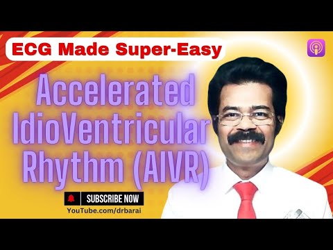 Accelerated idioventricular rhythm | AIVR | Palpitations | 2024