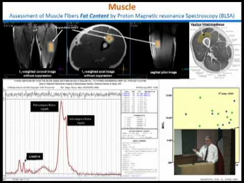 Luigi Ferrucci, MD, PhD  (Spring, 2012 Barshop Institute Seminar Series)