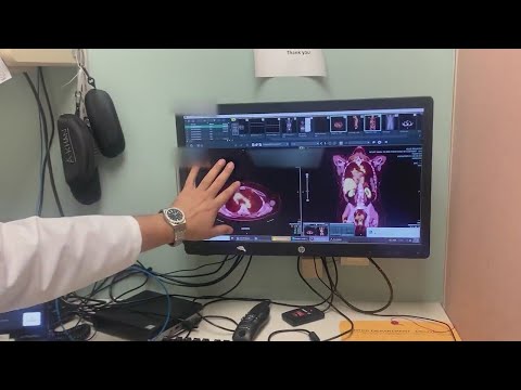 New AI tool helps diagnose patients at Ellis Medicine