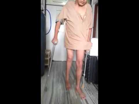 Dr.Shailendra Patil|Best Knee Replacement Surgeon And Hospital In Mulund