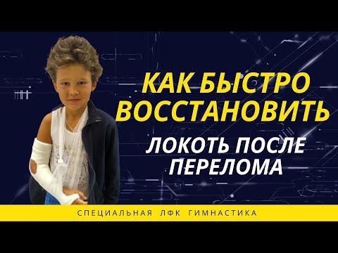 ЛФК после перелома локтя. Упражнения для разработки локтевого сустава (после перелома руки)