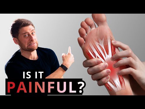 Plantar Fasciitis Heel Pain Treatment - What REALLY Works