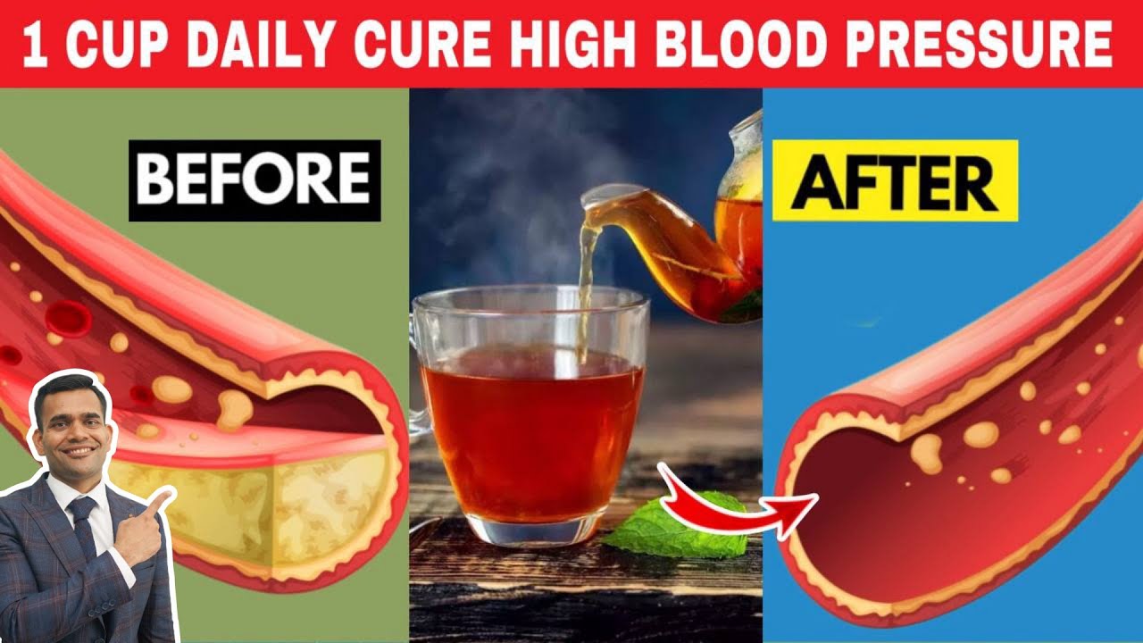 Drink Just 1 Cup Of This Tea Daily Lower Your Blood Pressure and Clean Your Arteries