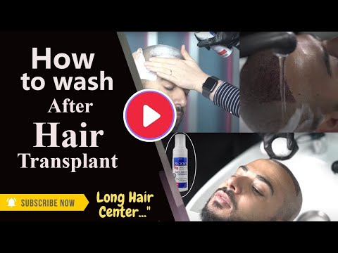 First Hair Wash After the Hair Transplant || Long hair center Istanbul