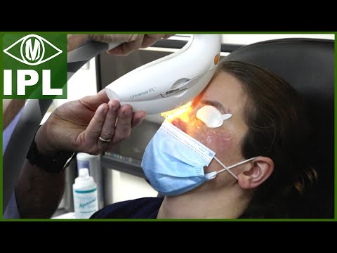 IPL Treatment for Dry Eye (Intense Pulsed Light...