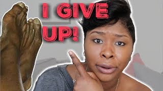 Getting Rid of my BLACK Toe Nails | Lets Talk with Stylist Lee Comedy