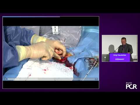 TricValve - Addressing the unmet need for patients with right HF & functional TR - EuroPCR2022