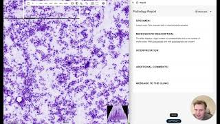 Voquill - Agentic dictation for pathologists