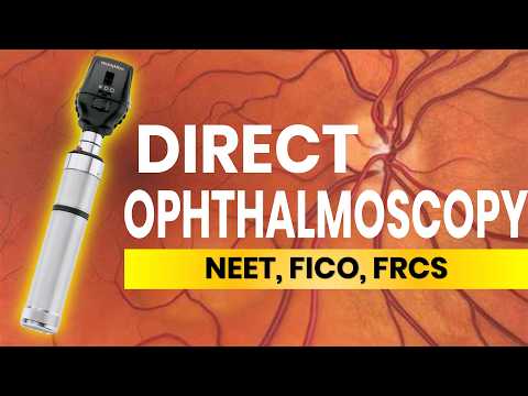 Direct Ophthalmoscopy |Tips and Tricks|