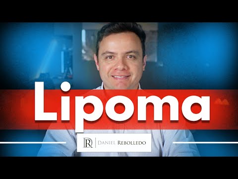 Lipoma. What is a Lipoma? Is a Lipoma Serious?