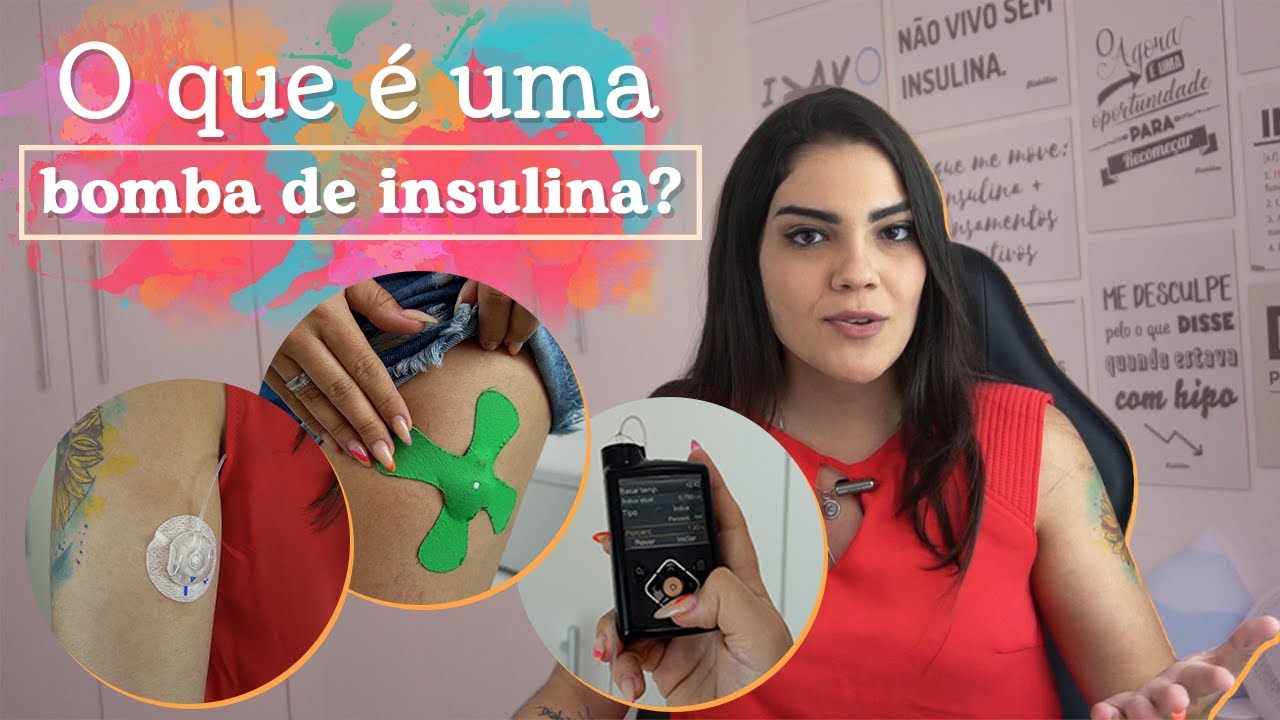 Tudo sobre Bomba de Insulina (ATUALIZADO 2022) | #Biabética #109