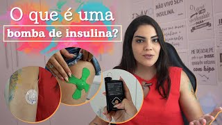 Tudo sobre Bomba de Insulina (ATUALIZADO 2022) | #Biabética #109