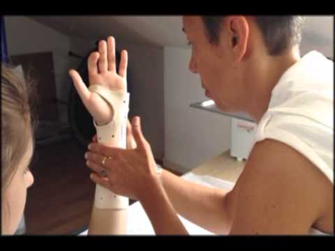 Quando piegato scatta articolazione del pollice Infiammazione dei muscoli dellanca