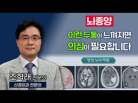 이런 두통이 느껴지면 의심이 필요합니다. 뇌종양의 두통 지침 한방에 정리! [ TV닥터인사이드 ] 231120