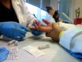 Capillary Stick