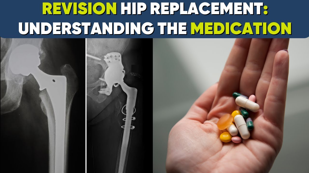 Medication for Revision Hip Replacement Surgery #totalhipreplacementsurgery
