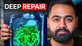 Doctor Explains How to Create a Supergut (5 Simple Steps)
