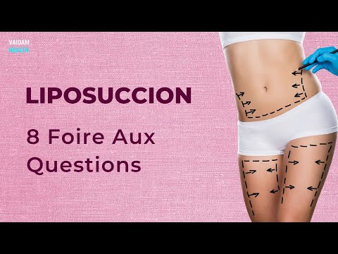 Liposuccion