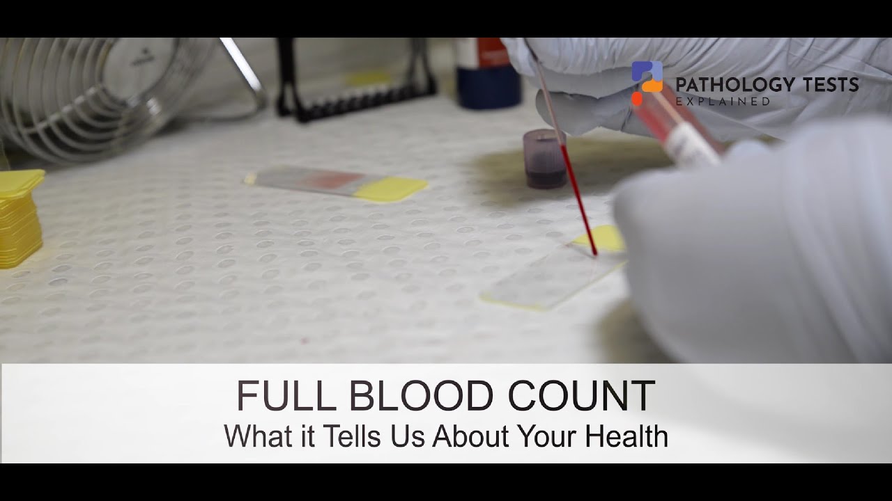 Can full blood count detect STDs?