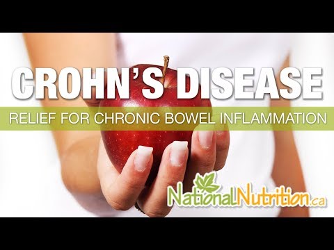 Crohn's Disease