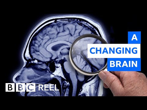How pregnancy dramatically resculpts the brain - BBC REEL