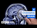 How Pregnancy Dramatically Resculpts The Brain BBC REEL