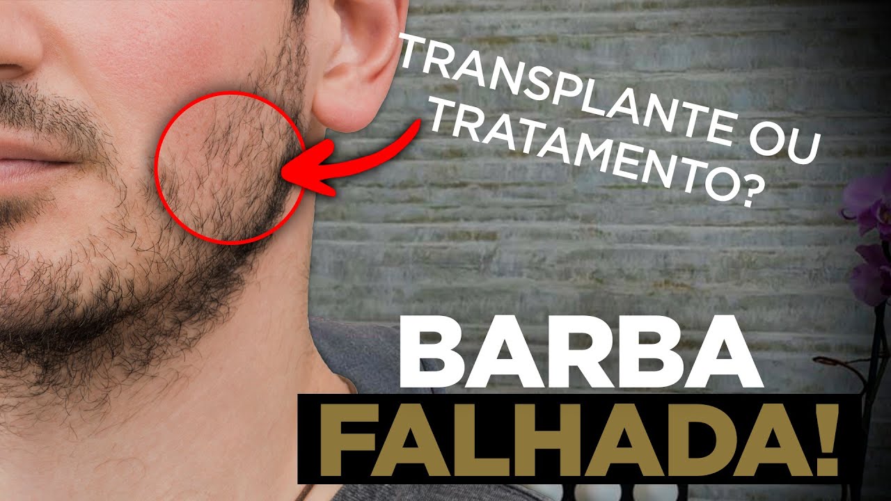 Como corrigir barba falhada? Principais soluções