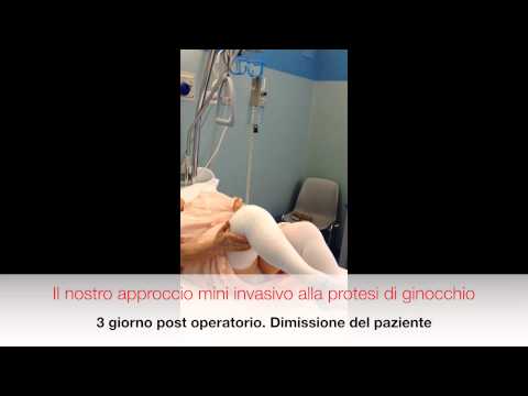 Dolori alle articolazioni Kalanchoe Valgo al ginocchio