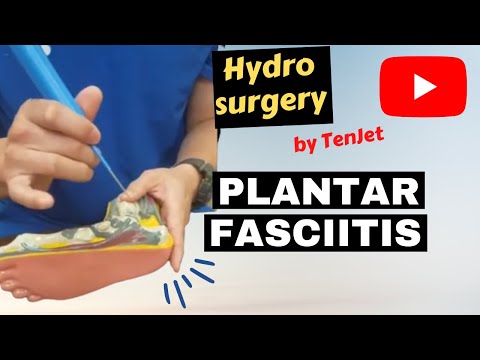 Difficult heel pain what you need to know now!