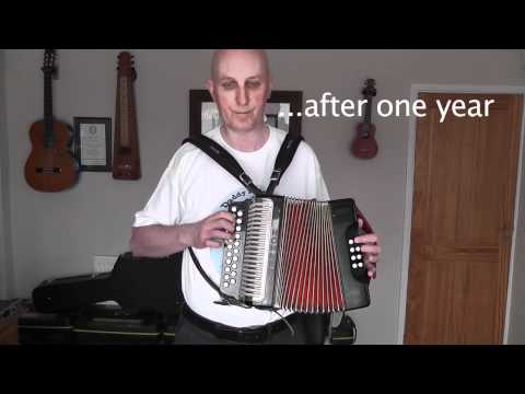 Learning To Play The Melodeon Blog 16 - One Year Report