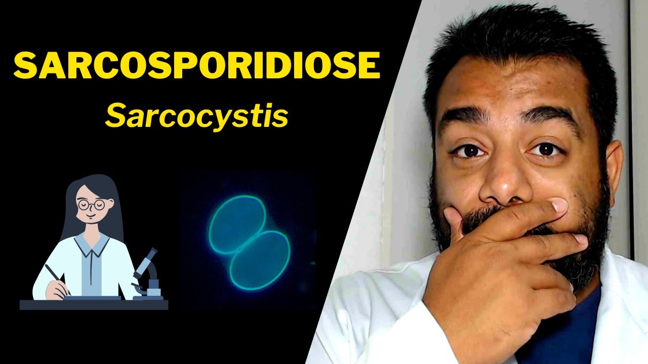 Sarcosporidiose (Sarcocystis) | Curso de #Parasitologia Humana Básica e Clínica | IBAP Cursos