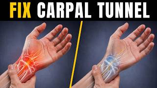 Avoid Carpal Tunnel Surgery with These 4 Exercises